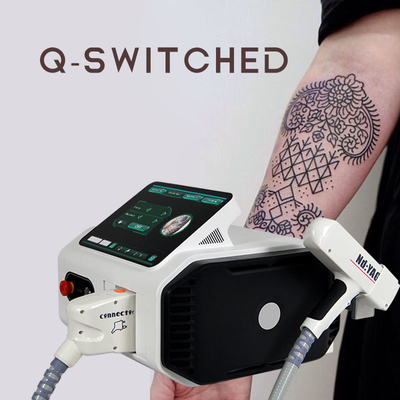 Remoção da tatuagem do laser do Nd Yag do melhor